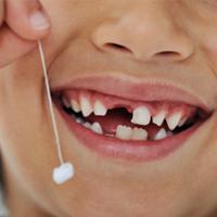 Молочные зубы: секрет лечения