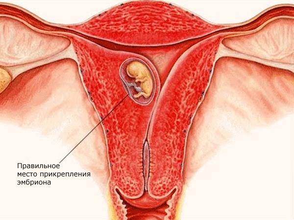 Правильные место имплантации и развитие эмбриона