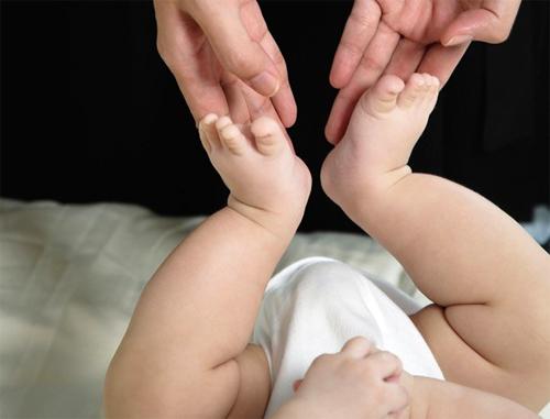 Тазобедренная дисплазия: лечение у новорожденных