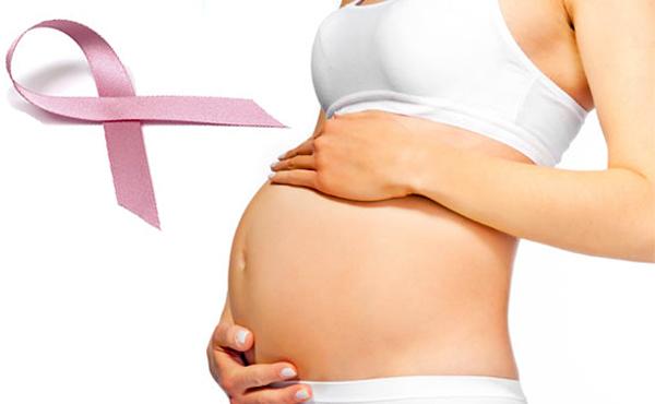 Рак груди во время беременности