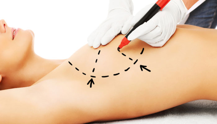 Эстетическая хирургия