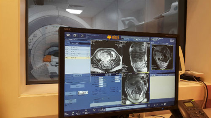 Как проводится МРТ брюшной полости в СПб?